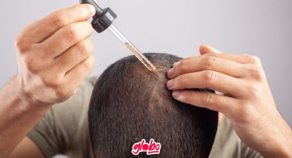 ¿Qué es el Minoxidil y quiénes pueden usarlo?