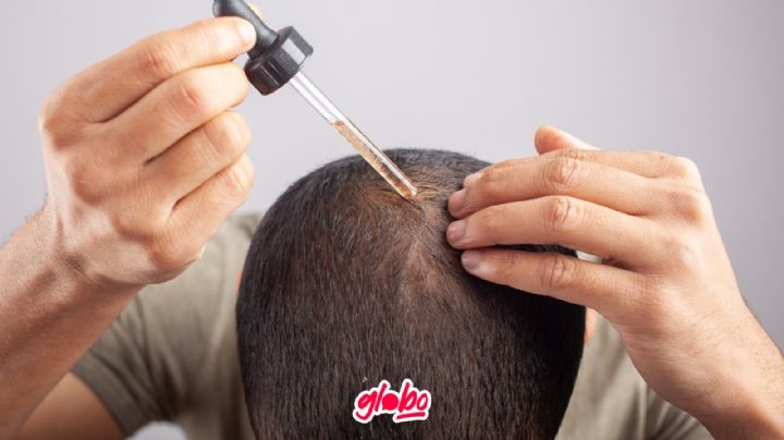 ¿Qué es el Minoxidil y quiénes pueden usarlo?