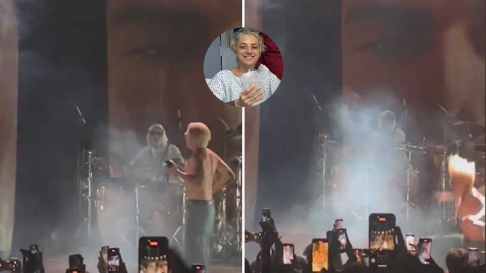 Paco Amoroso sufre fuerte caída durante concierto en la CDMX, este es su estado de salud.