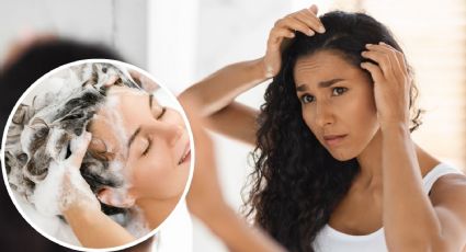 ¿Cuál es el mejor shampoo contra la caspa? Así puedes aliviar los síntomas