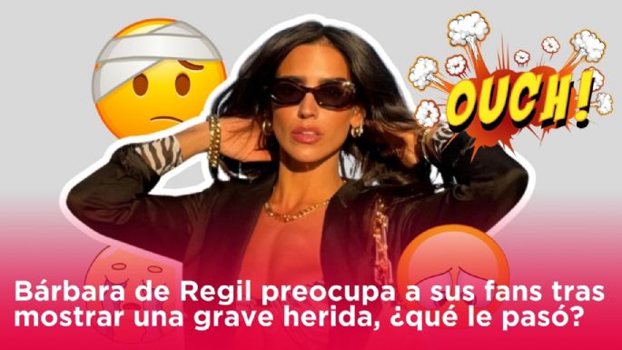 Bárbara de Regil preocupa a sus fans tras mostrar una grave herida, ¿qué le pasó?